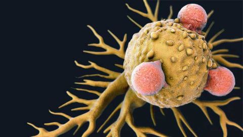 Lactic Acid Impairs the Immune System’s Ability To Kill Cancer Cells