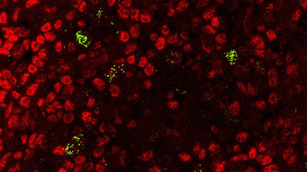 Autoimmunity Prevented by "Boot Camp" Enzyme