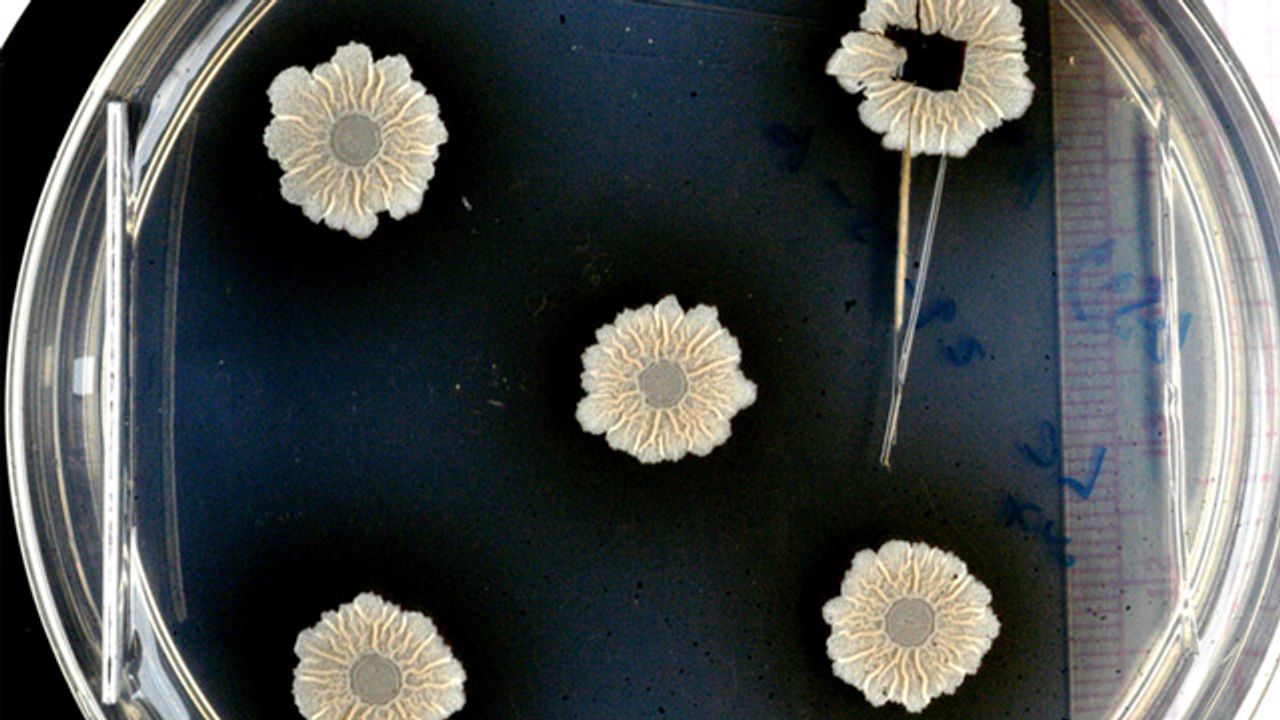 Biofilm Secrets Revealed by Synchrotron Study