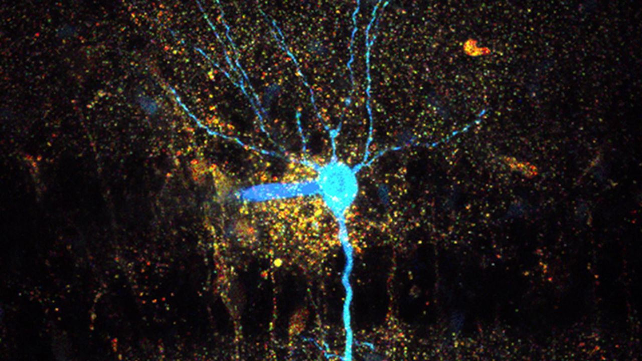New Imaging Technique Reveals Causes of Swelling in the Brain
