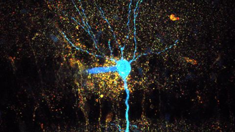 New Imaging Technique Reveals Causes of Swelling in the Brain