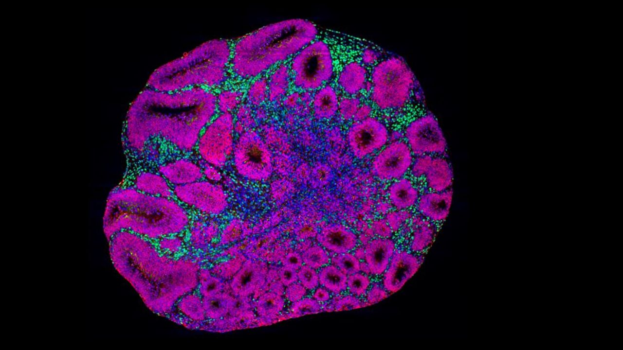 Different Autism Risk Genes Have Similar Effects on Brain Development