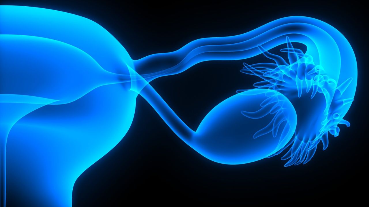 Ovarian Cancer With Dr. Mara Artibani