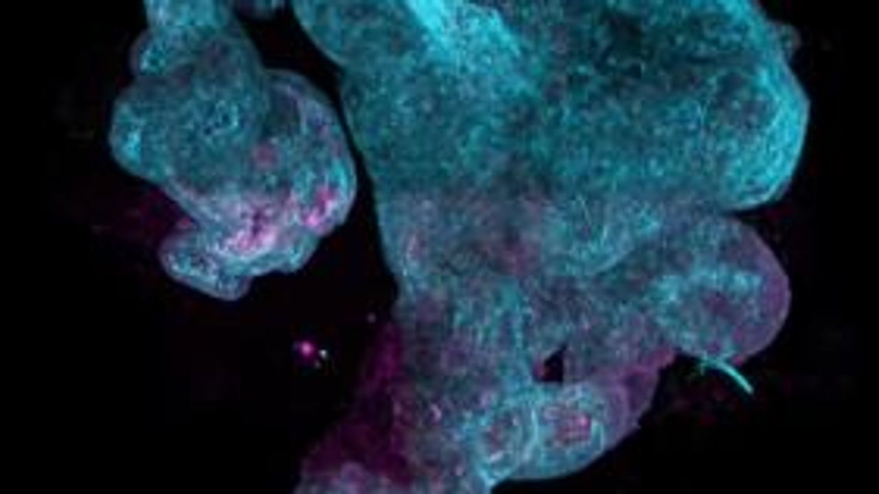 COVID-19 and Organoids: Mini Organs With Massive Potential
