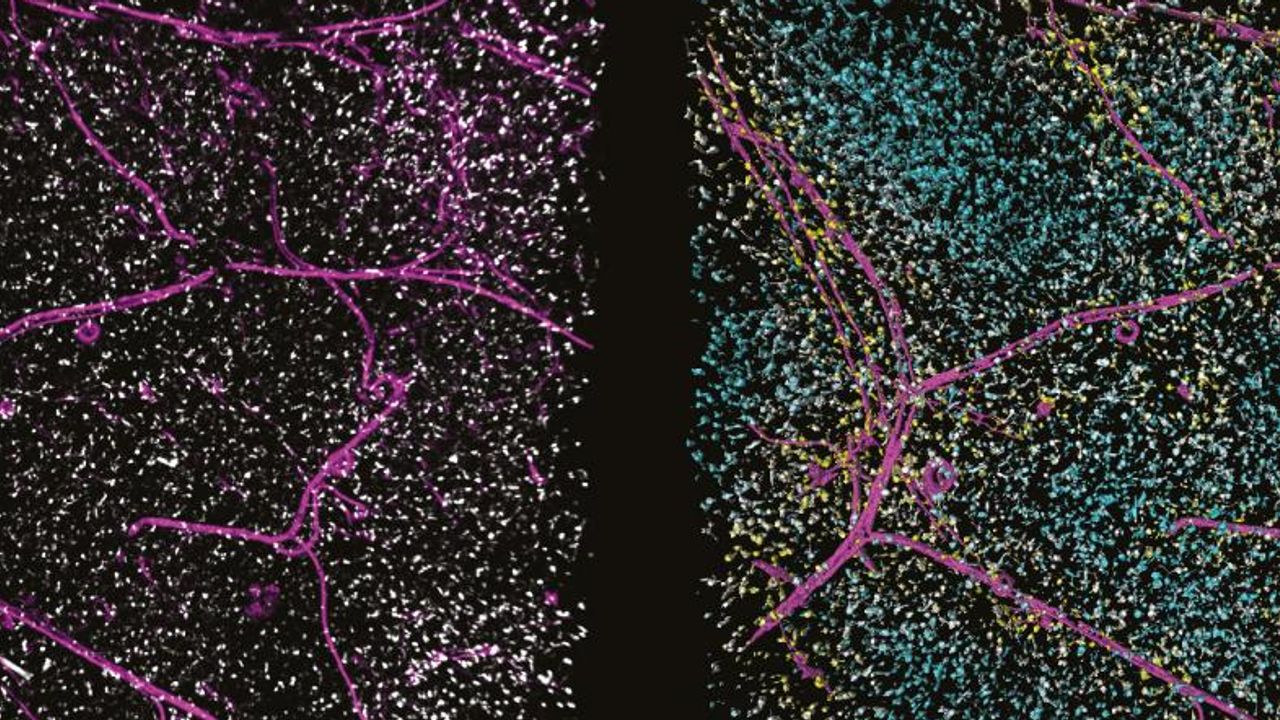 Accurately Analyze Fluorescent Widefield Images