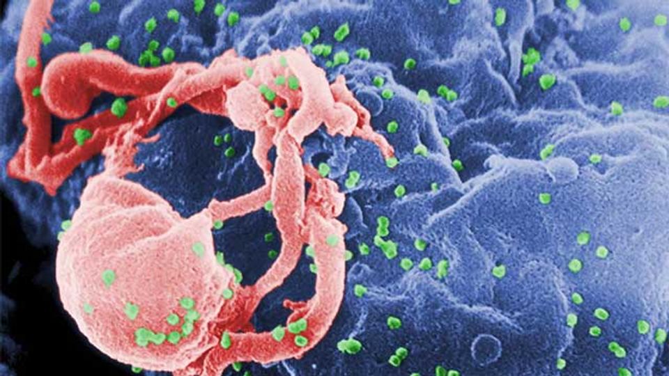 New Insights Into the Cells That Host HIV content piece image