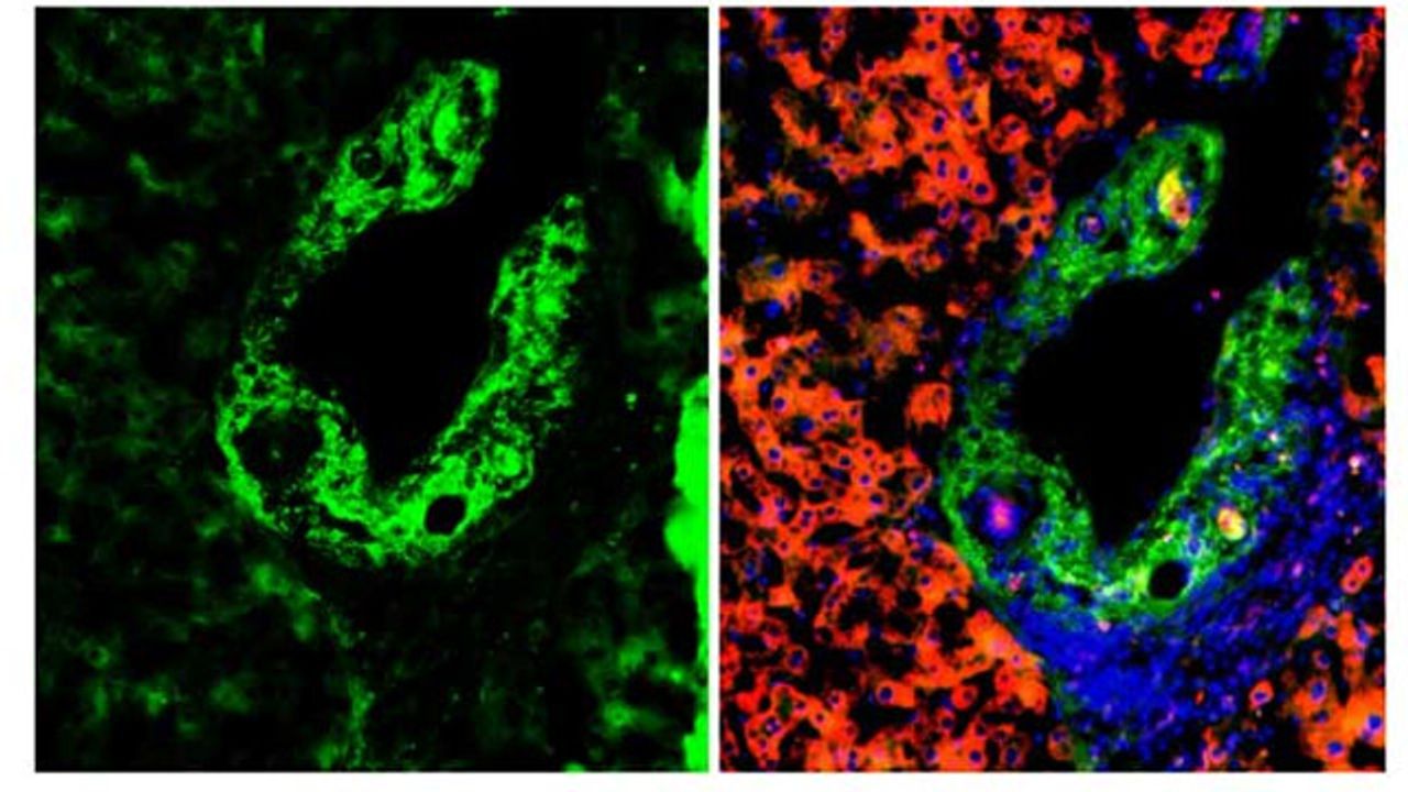 Team Discovers How Tumor Suppressor pVHL Influences Cell Signaling