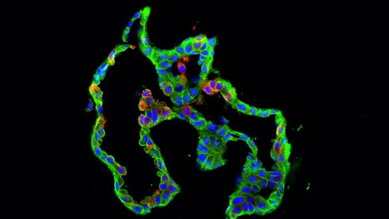 How <i>KRAS</i> Oncogenes Drive Tumor Formation