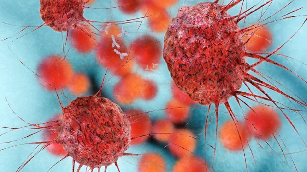 Colorectal Cancers Oversecrete Proteins To Produce Defensive Barrier Against Chemo