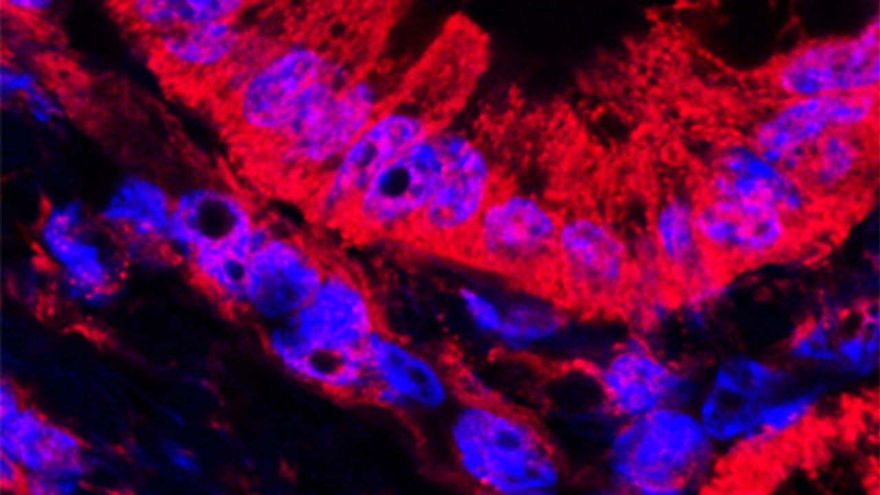 Compound Extends Survival in Mouse Model of Pancreatic Cancer
