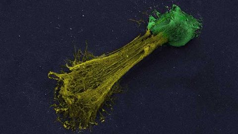 Drug Could Be Used To Prevent Immune Reactions and Save Damaged Lungs