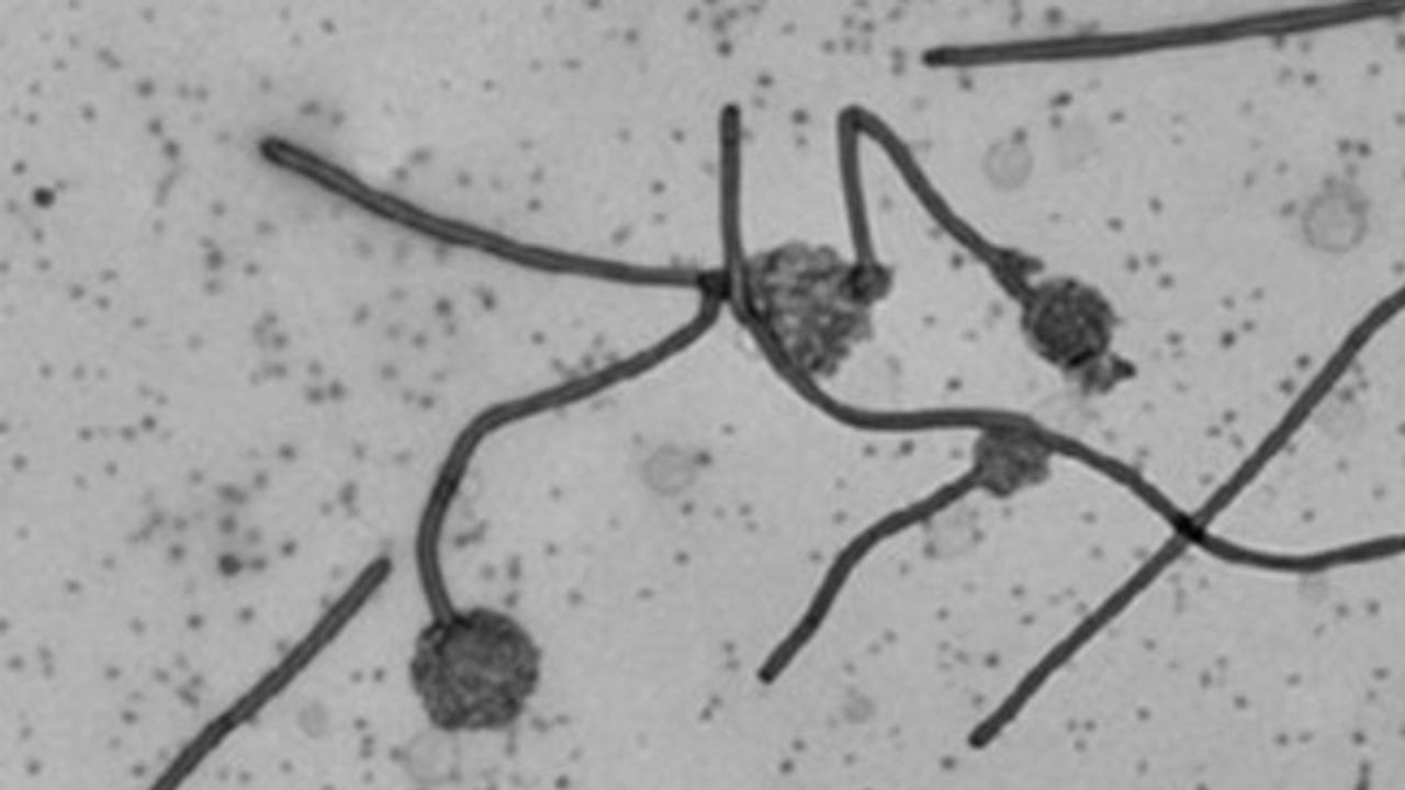 <i>Vibrio cholerae</i> Protein Causes Membrane Remodeling Through a Novel Mechanism