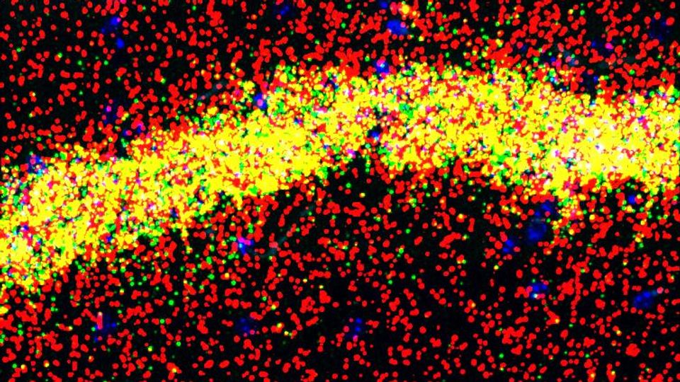 Second Role for Fragile X Protein Linked to Learning and Memory content piece image