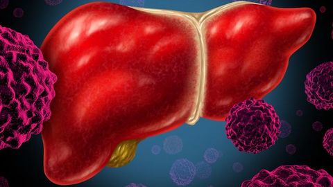 Restoring Function in Gene Suppresses Liver Cancer and Boosts Immunotherapy
