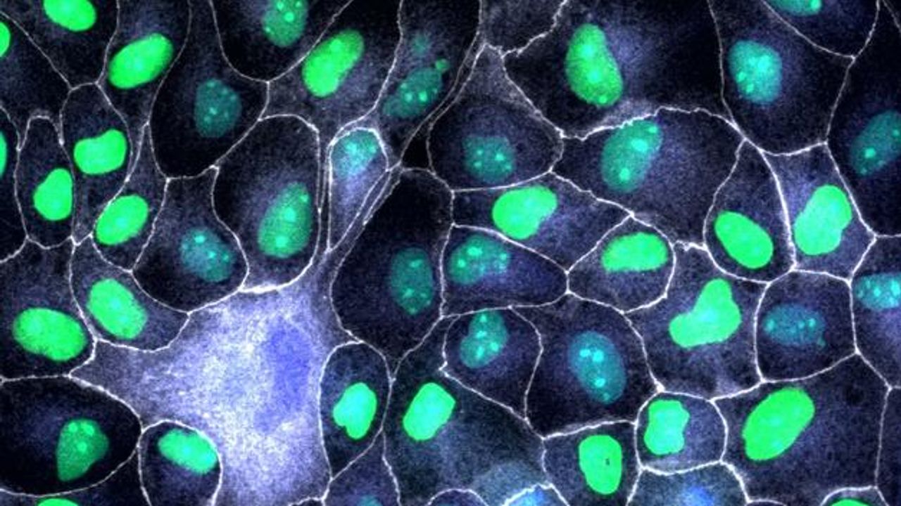 P53 Protein a Key Player in Tissue Repair