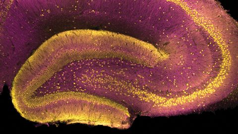 Schizophrenia-Linked Protein Found in Unexpected Brain Region