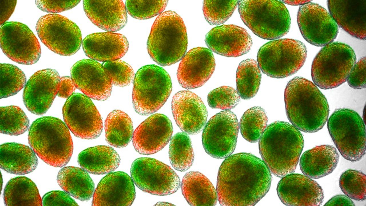 Mini-Brain Organoids Could Be Made More Quickly Using New Technique