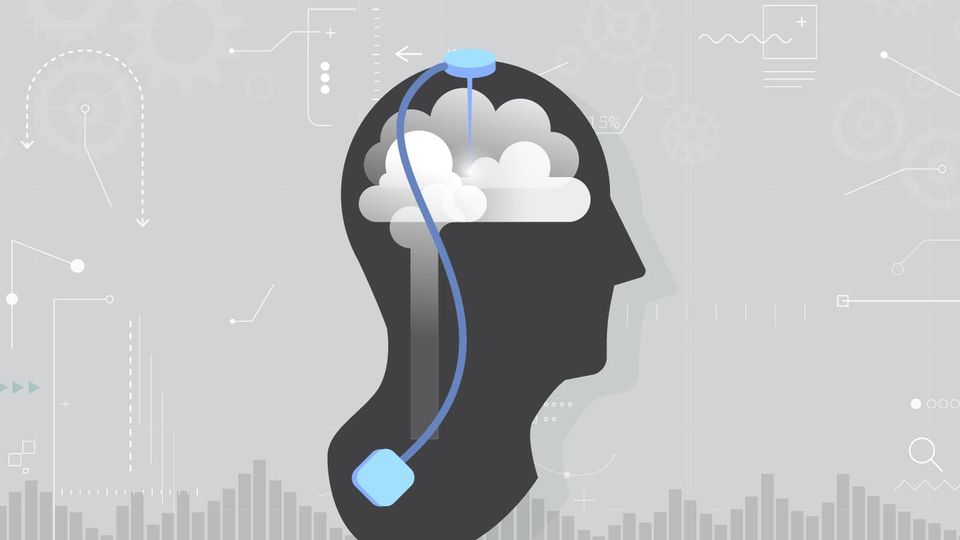 Illustration of a deep brain stimulator.