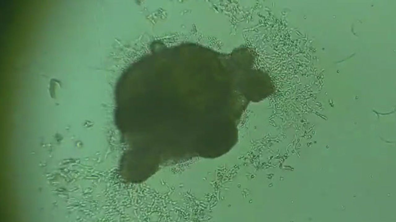 Cerebral Organoid Growing on Laminin
