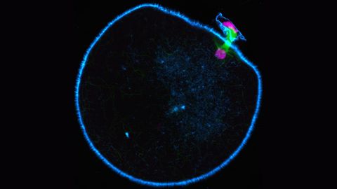 Missing Motor Protein Causes Instability in Human Oocytes