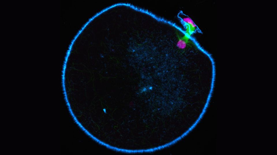 Missing Motor Protein Causes Instability in Human Oocytes content piece image