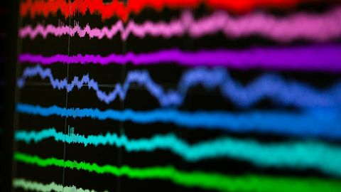 "Math Neurons" Identified in the Brain