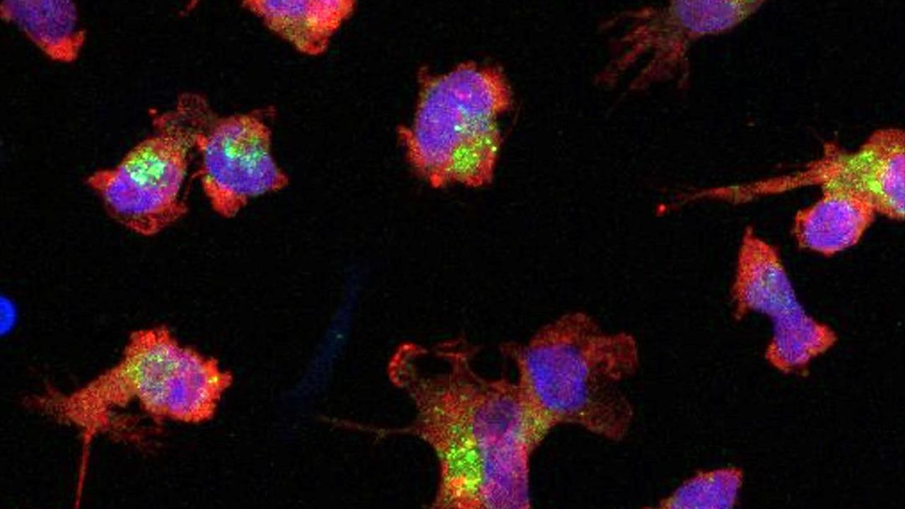 Highly Responsive Immune Cells May Be Beneficial for the Brain