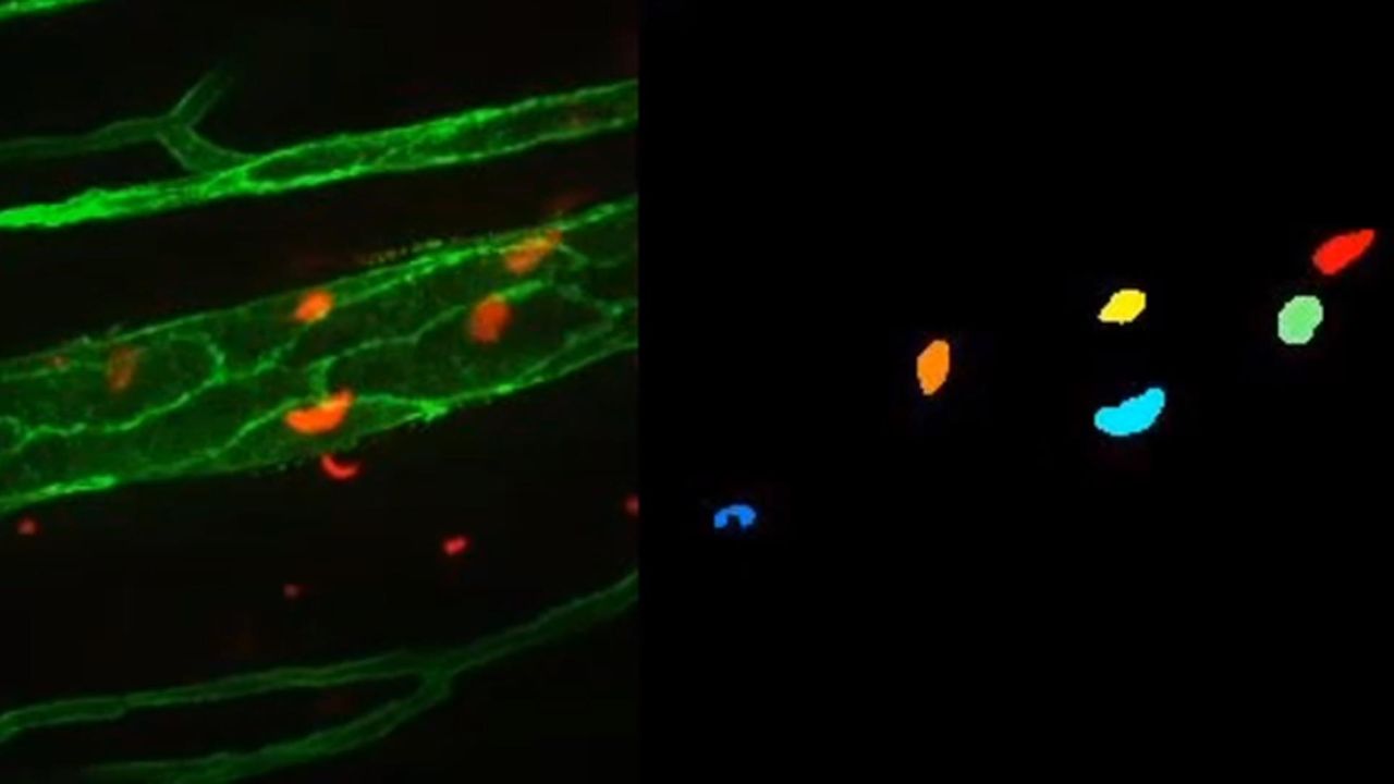 Computer Vision System Allows Analysis of Microscopy Videos