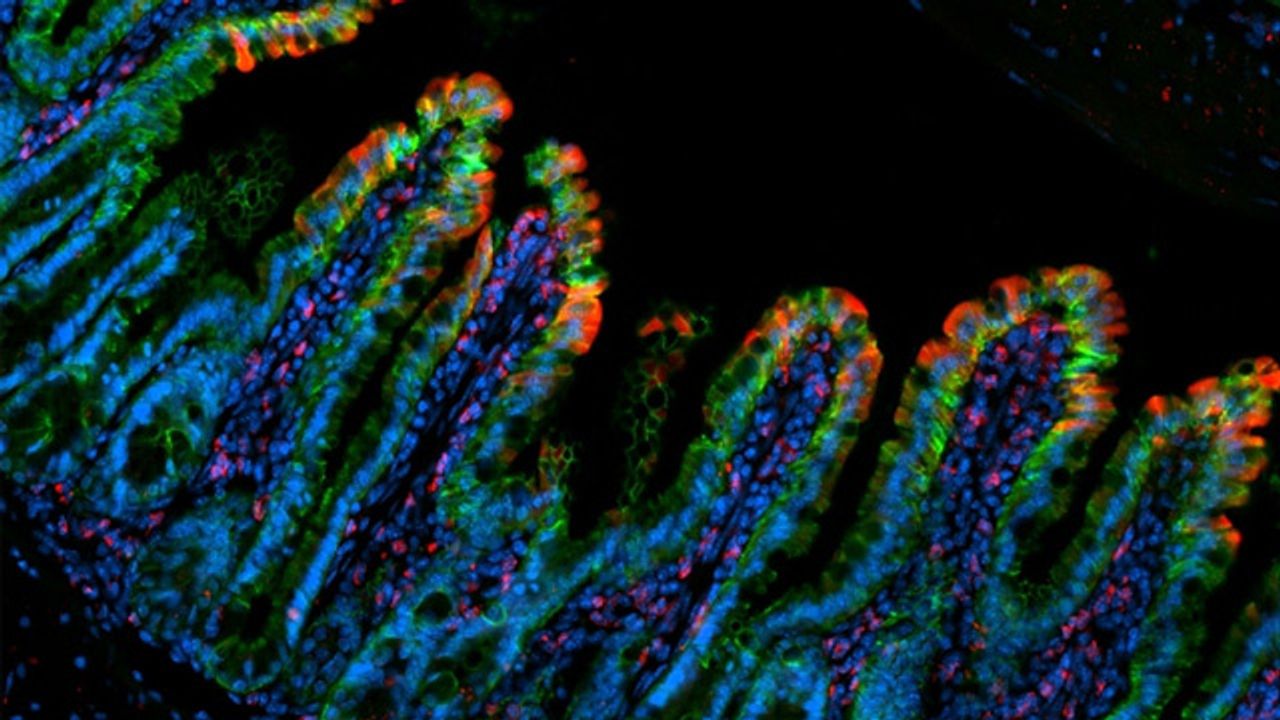 Intestinal Inflammation