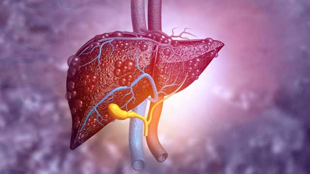 Effective Diagnostics for Liver Disease Are Urgently Needed