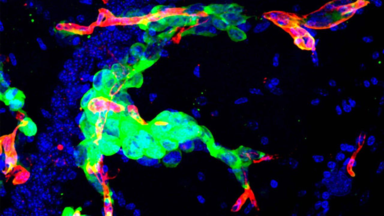 A Drug Screening Platform Compatible With Cancer Patient Biopsies