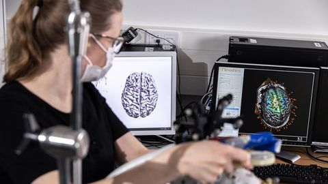 The Algorithm That Could Make Brain Stimulation More Reliable