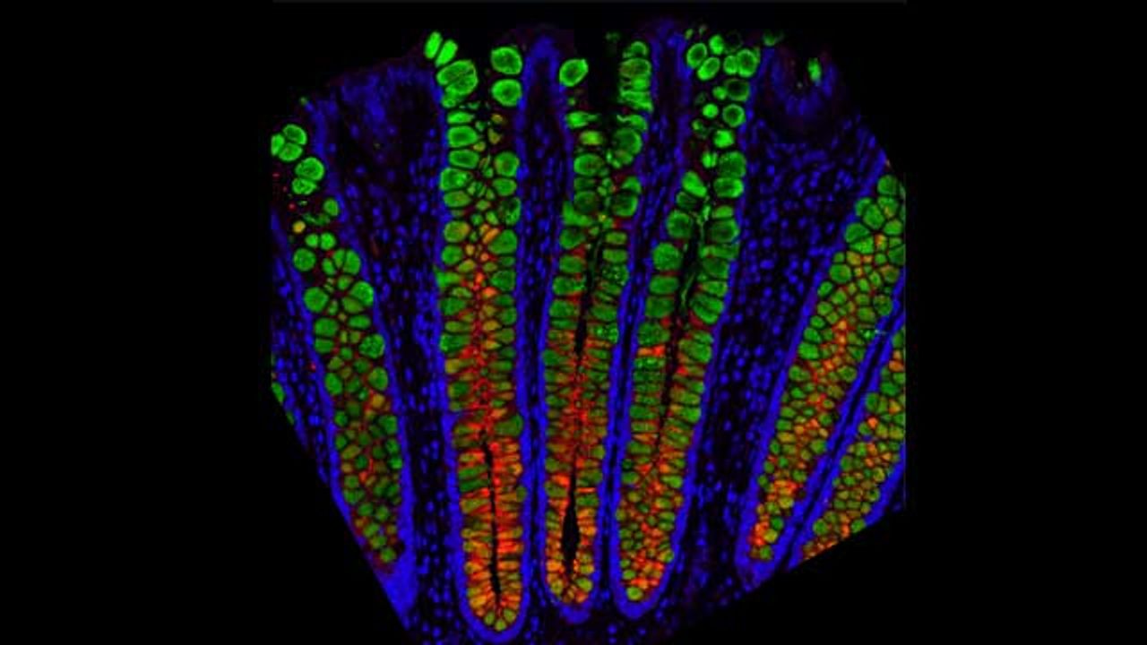 Entire Human Gut Mapped at Single-Cell Resolution