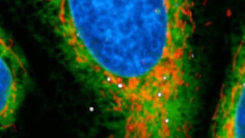 Novel Mechanism Explains How Legionella Is Able To Manipulate Host Cell Immune Responses