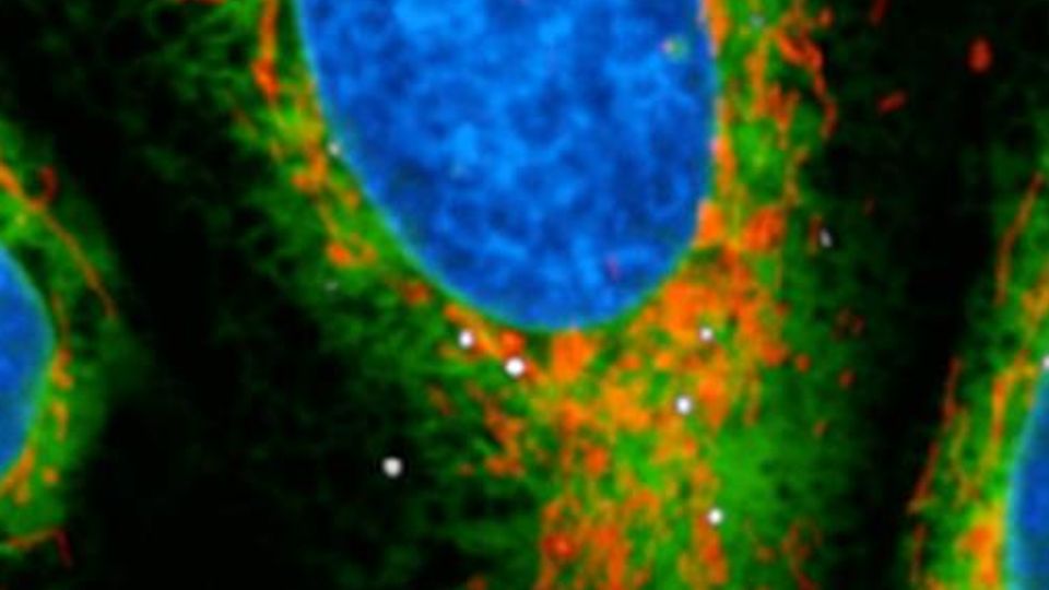 Novel Mechanism Explains How Legionella Is Able To Manipulate Host Cell Immune Responses content piece image