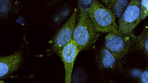 Some Human RNA Able To Resist Viral Takeover