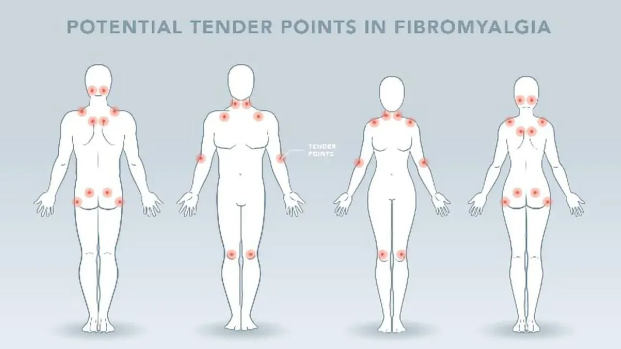 Study Examines the Brain in Juvenile Fibromyalgia for the First Time