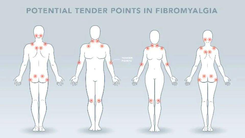Study Examines the Brain in Juvenile Fibromyalgia for the First Time content piece image