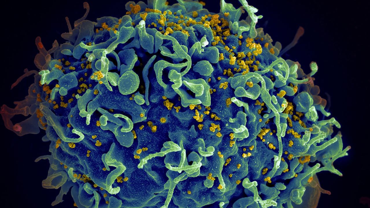 Neanderthal Gene Increases Risk of Severe COVID-19 but May Offer Protection Against HIV