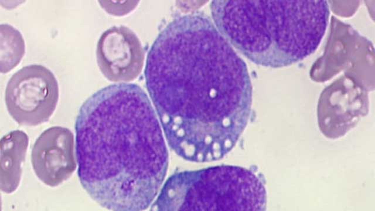 Killing Leukemia Cells by Disrupting Their Energy Supply