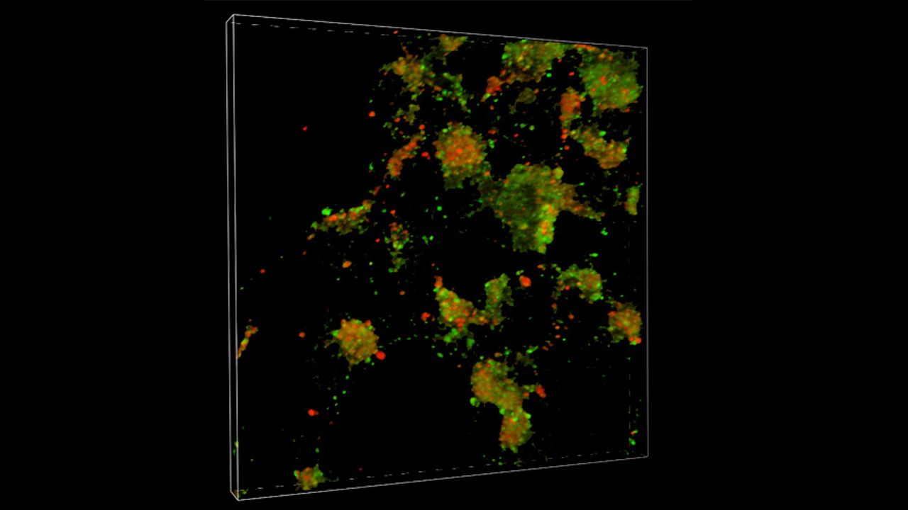Impaired Cell Cleanup Could Drive Parkinson's Disease