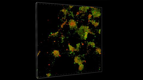 Impaired Cell Cleanup Could Drive Parkinson's Disease