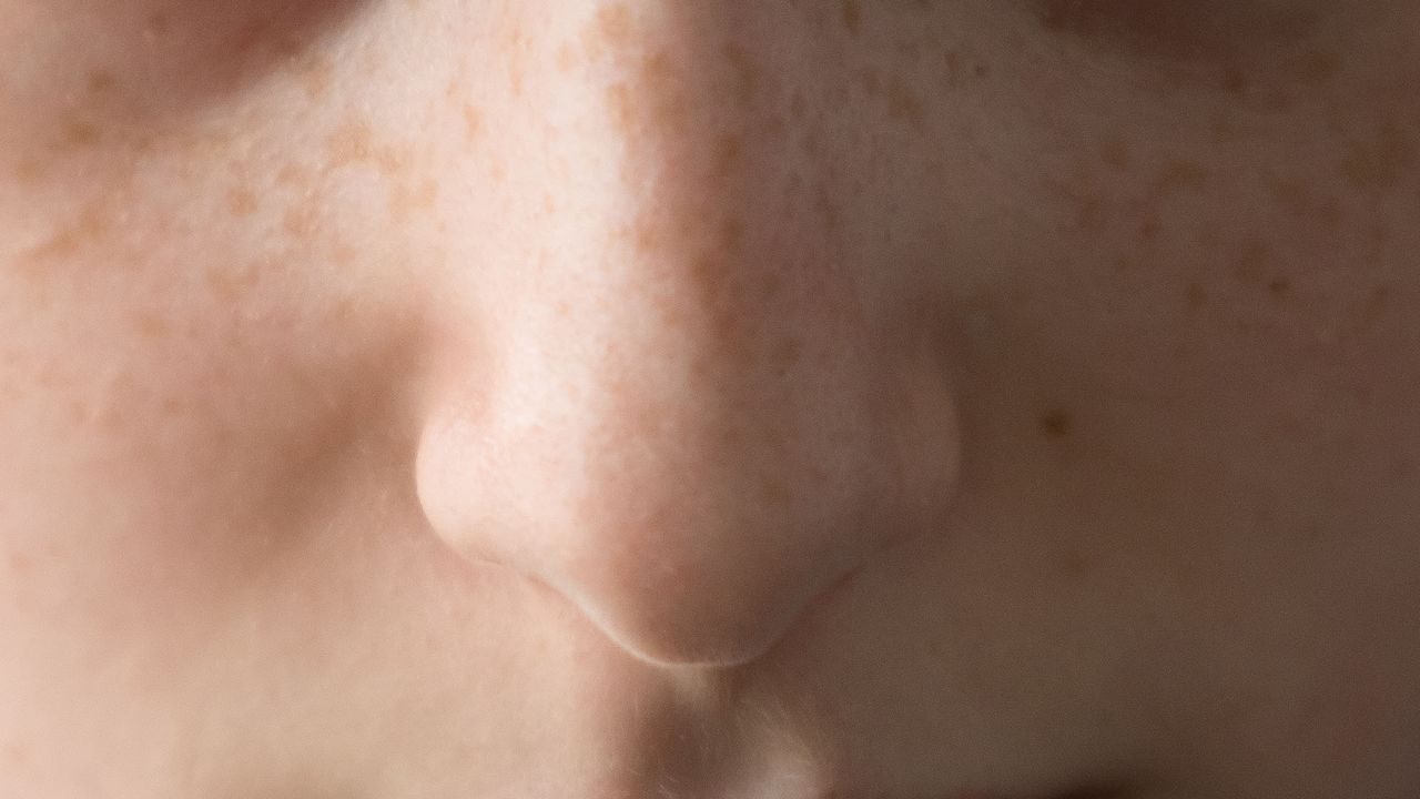Researchers Design "e-Nose" That Could Sniff Out Parkinson's