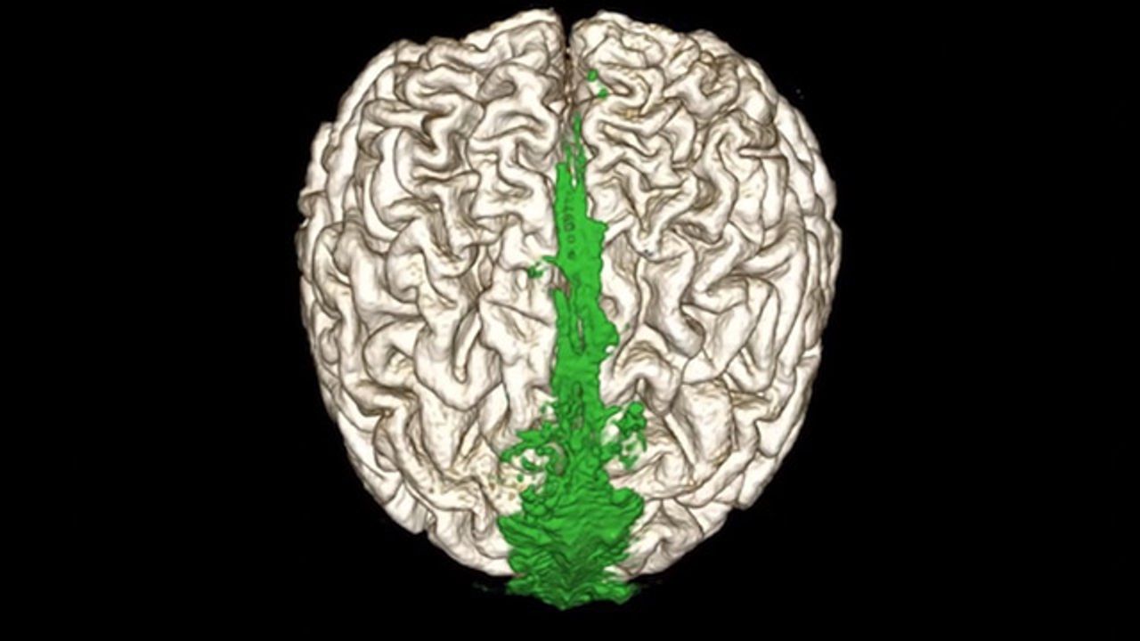 Brain Drain: A Look Inside the Brain's Waste Clearance System