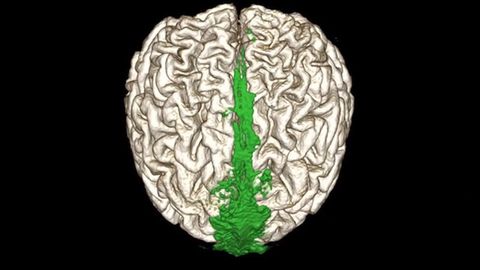 Brain Drain: A Look Inside the Brain's Waste Clearance System