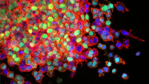 Immune Response to Tissue Damage Influences Cancer’s Spread