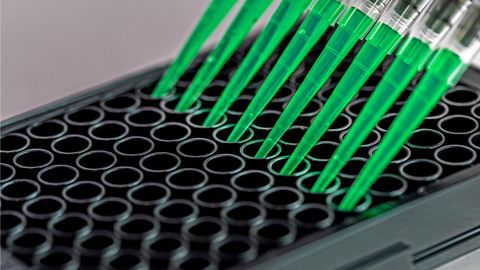 Expanded Range of Nucleic Acid Extraction Kits for Pathogens Detection Expanded Range of Nucleic Acid Extraction Kits for Pathogens Detection