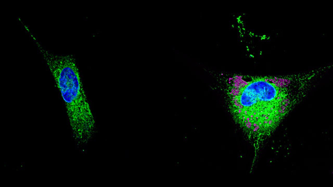 Astrocytic Lipids Could Contribute to the Spread of Alzheimer's