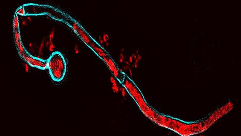 How Our Immune System Is Hijacked by a Fungus