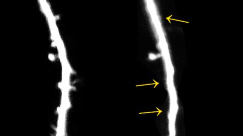 Stress Has Adverse Effect on the Learning of Movements in Mice